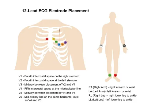 為什麼心電圖要用 10 條導線？RA/LA/RL/LL/V1~V6 全解析